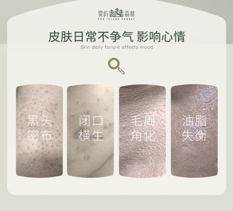 雾屿森林水杨酸棉片洁净闭口粉刺黑头毛周角化温和净痘印（1%日常水杨酸） 3盒180片【顽固痘肌必囤】