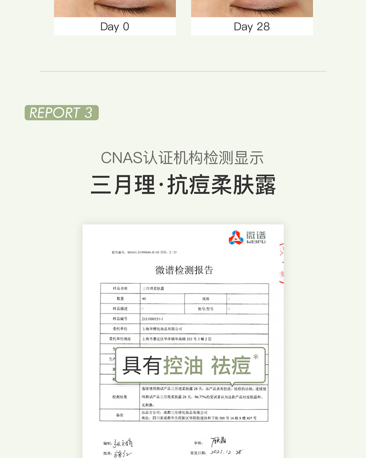 三月理 抗痘柔肤露100ml油痘肌清爽温和祛痘平衡水油痘印男女补水保湿