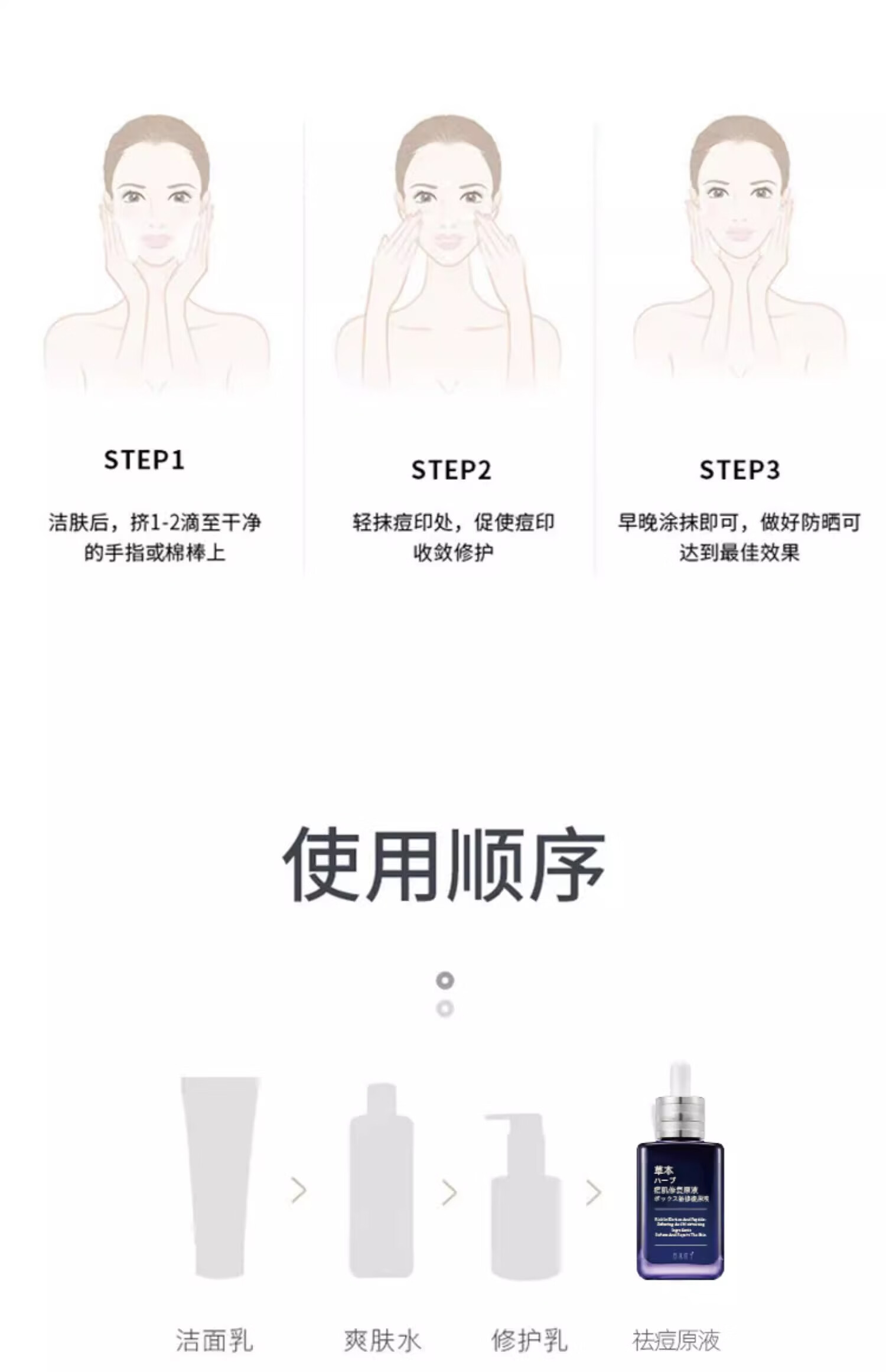 NHFOUYOU祛痘精华液祛痘膏去闭口粉刺痘坑痘印淡化消印收缩毛孔精华液 一瓶【30ml】建议按疗程使用