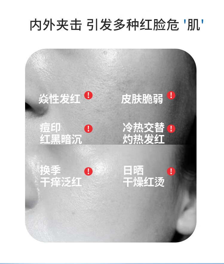 皮宝舒缓修护精华液敏感肌修红维稳强韧屏障补水保湿护肤品 小蓝瓶60ml（30ml*2）