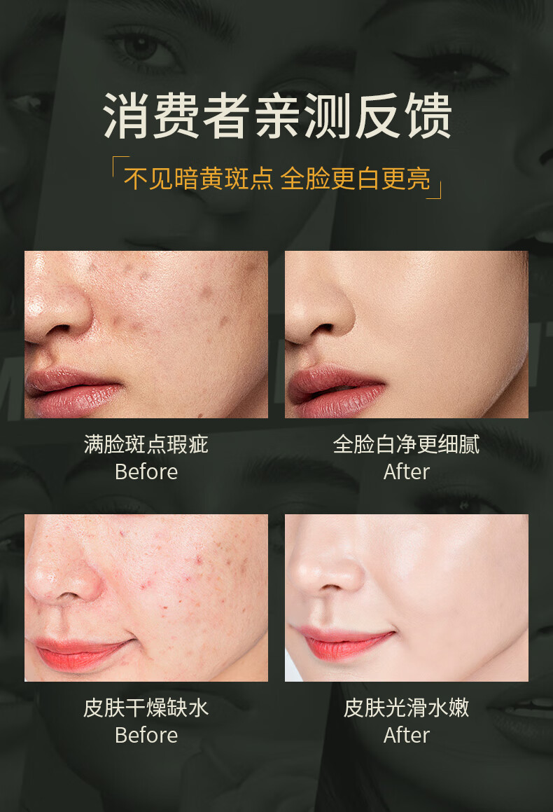 SKISGEM原装进口美白淡斑补水面膜提亮肤色锁水保湿滋润去黄气暗沉女男士 【95%人选择】祛斑面膜20片装