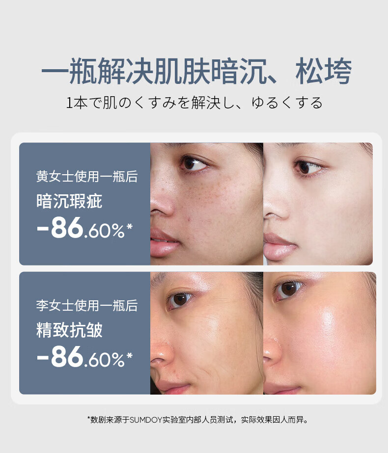 SUMDOY日本进口美白精华液补水保湿抗皱提拉紧致收缩毛孔烟酰胺原液 美白抗皱精华液30ml