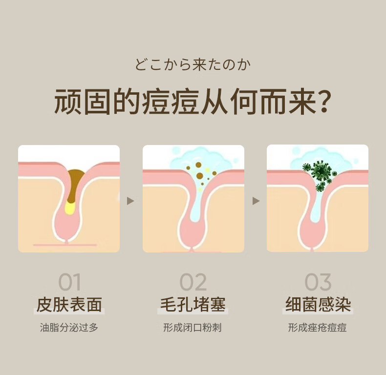 SUMDOY日本进口壬二酸祛痘印痘坑修复膏去痘红肿淡化痘印痘疤女男士 水杨酸30ml+祛痘膏30g