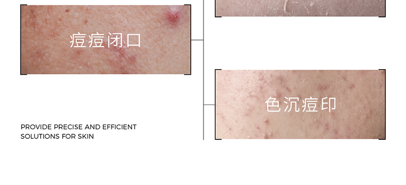 ddg果篮精华果酸杏仁酸控油亮肤去角质闭口面部提亮舒缓修护 30g（享同款5g）