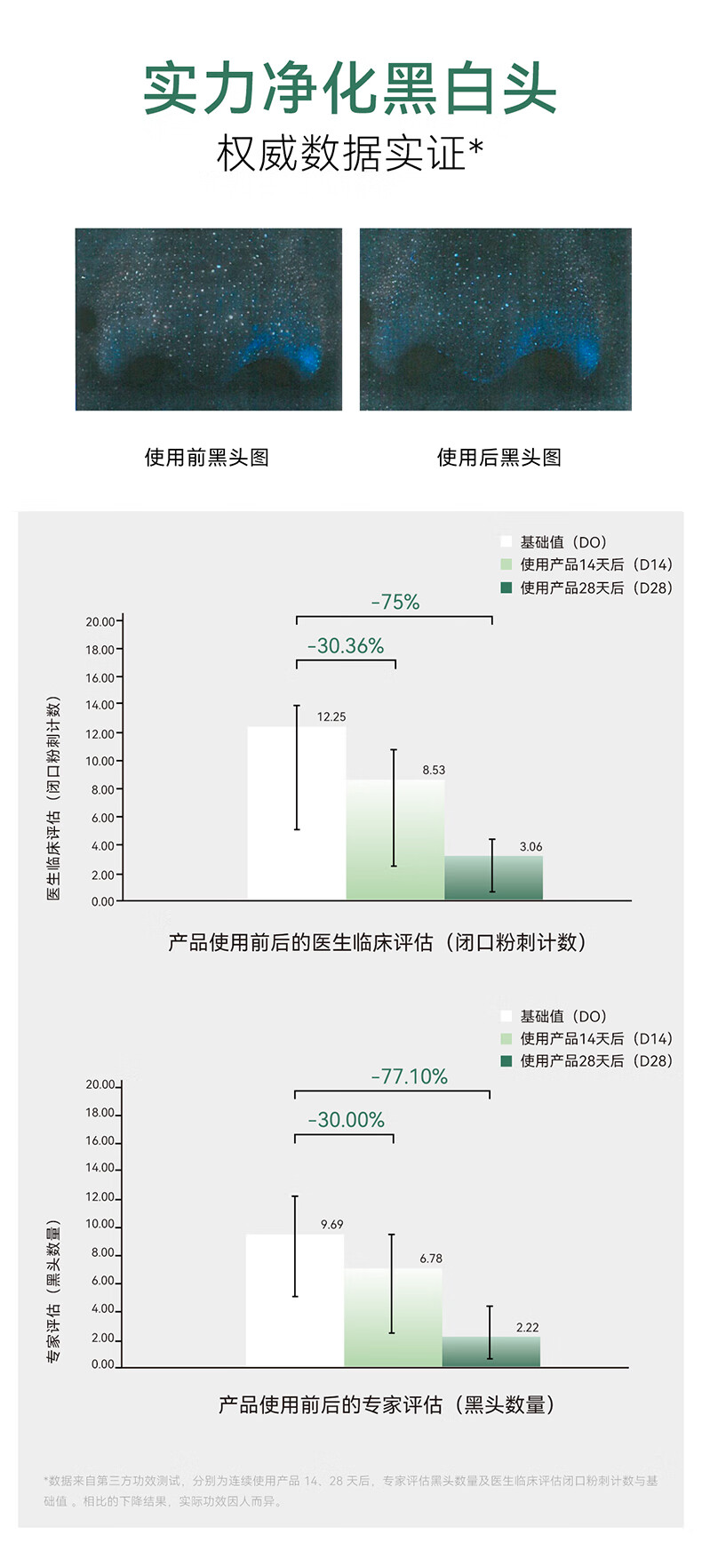 安修泽（ONCUR）清洁泥膜 水杨酸果酸涂抹面膜深层清洁毛孔控油去七夕情人节礼物 120g