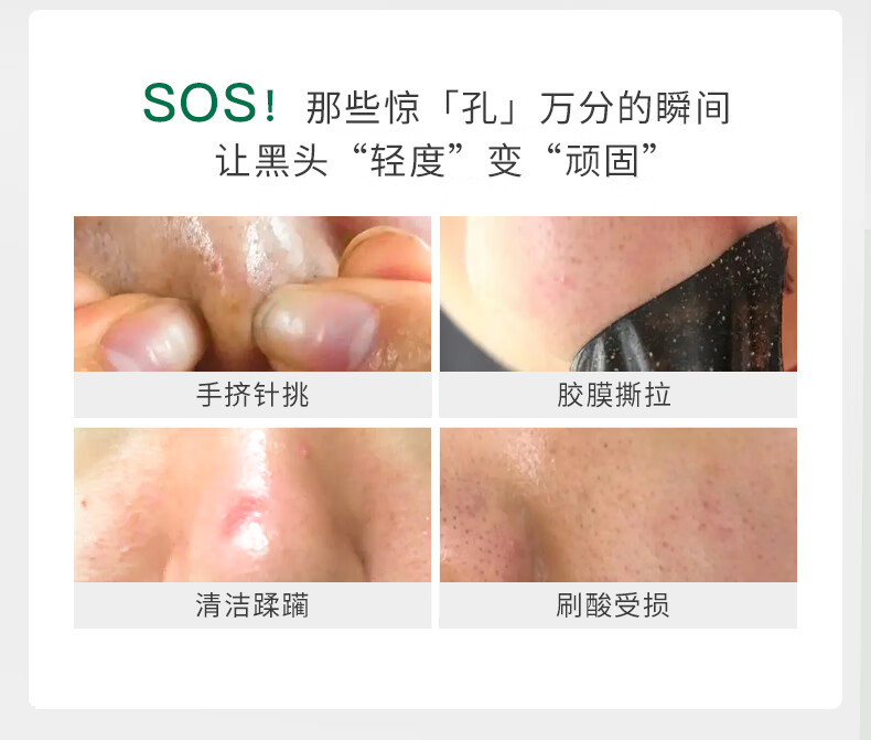 柏翠丝（Bytree's） 茶树去黑头套装清洁收细毛孔黑头收割机闭口精华鼻贴
