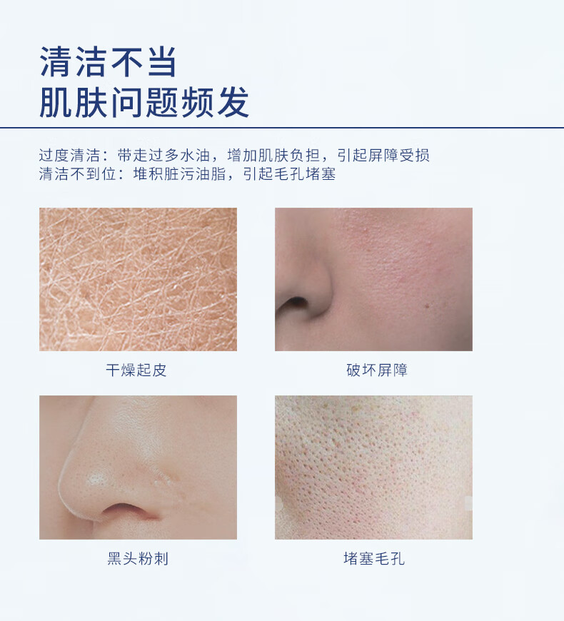 安碧妍氨基酸深层清洁毛孔控油泡沫洁面乳敏感肌温和保湿洁面乳洗面奶 洁面乳一支（共120g）