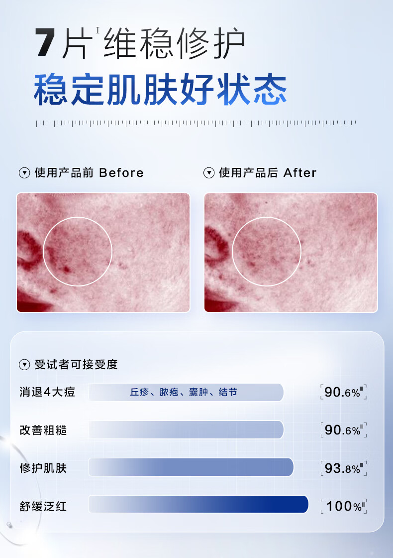 创尔美（Trauemy） 活性胶原多效修护面膜 淡化痘痘 补水保湿修护免洗修护男女 胶原多效面膜1盒  （5片/盒）