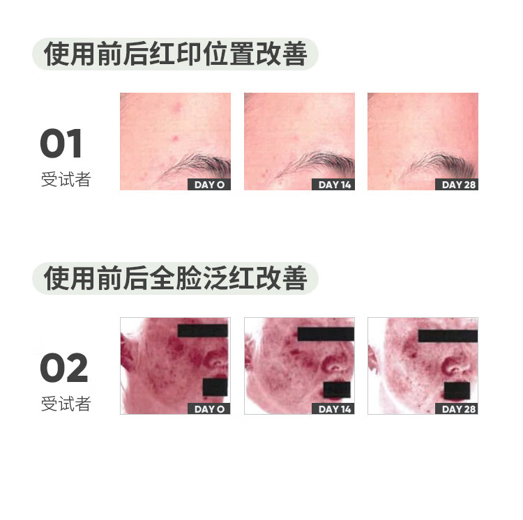果壳色修净颜精华液修护敏感肌泛红皮肤屏障改善痘后红印面部精华 【大瓶装50ml】老客推荐囤货款