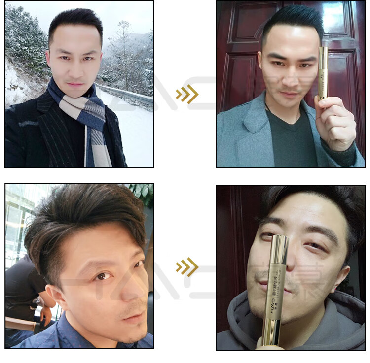 寒慕眉毛精华液男一字浓眉剑眉营养植萃液女自然浓密温和滋润乌黑养眉 【眉毛液2支装】男女通用