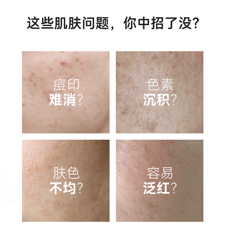 安修泽（ONCUR） 色修精华 20%油橄榄精华舒缓补水提亮改善印痕肌 30ml