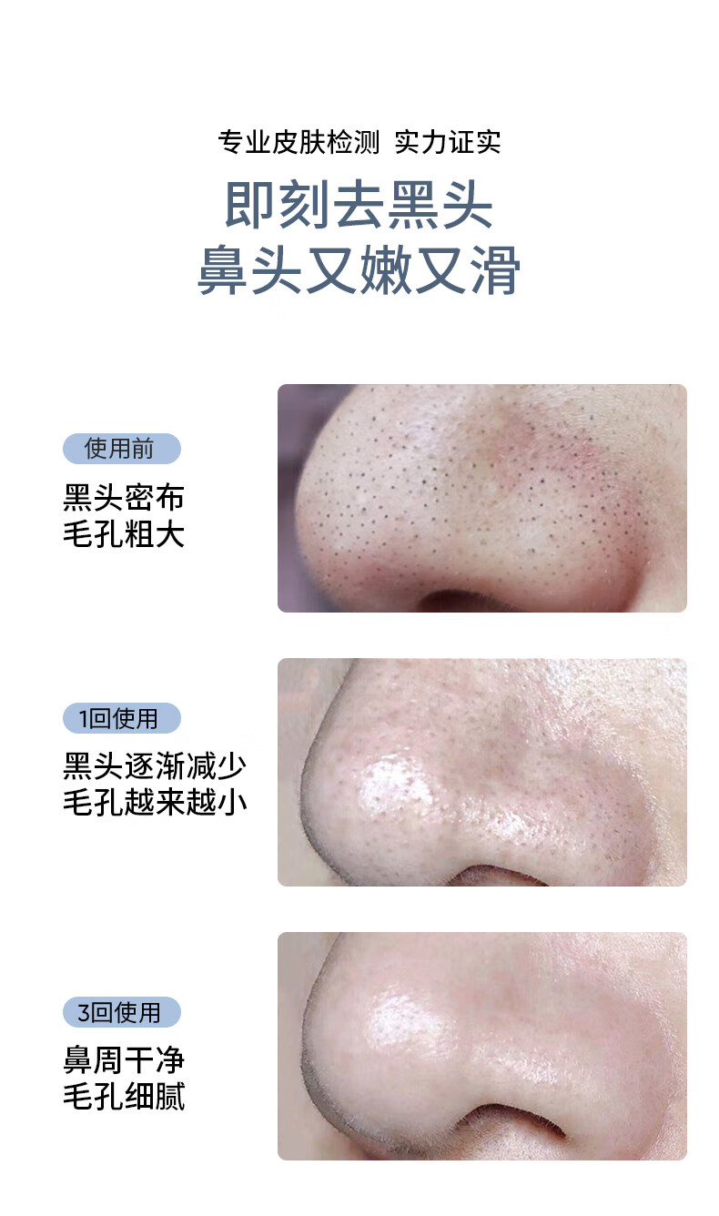 SUMDOY 日本进口去黑头面膜清洁去粉刺鼻贴收缩毛孔液套装男女士鼻膜 【深层清洁毛孔】三部曲