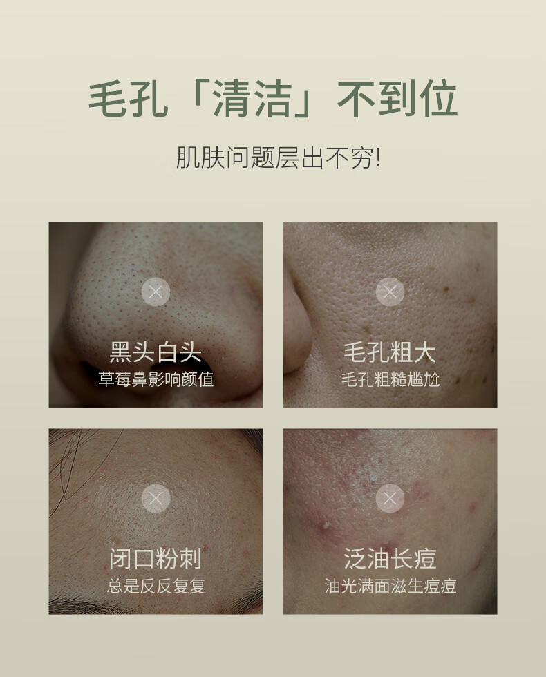 SKISGEM德国进口清洁面膜祛痘泥膜去黑头粉刺涂抹式补水收缩毛孔男女士 深层清洁收缩毛孔240g
