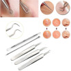 5Pcs Extractor De Espinillas De Manchas De Acné Facial Inoxidable Herramienta Extractora Comedone