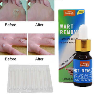 Remove Old Dead Skin Whitening Beauty Skin Care Solution 10ml 
Remove Old Dead Skin Whitening Beauty Skin Care Solution 10ml