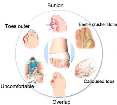 1 Pair Silicone Soft Gel Feet Care Toe Care Forefoot Cushion Half-Yard Hallux Valgus Pedicure Health Care For Foot Valgus
1 Pair Silicone Soft Gel Feet Care Toe Care Forefoot Cushion Half-Yard Hallux Valgus Pedicure Health Care For Foot Valgus