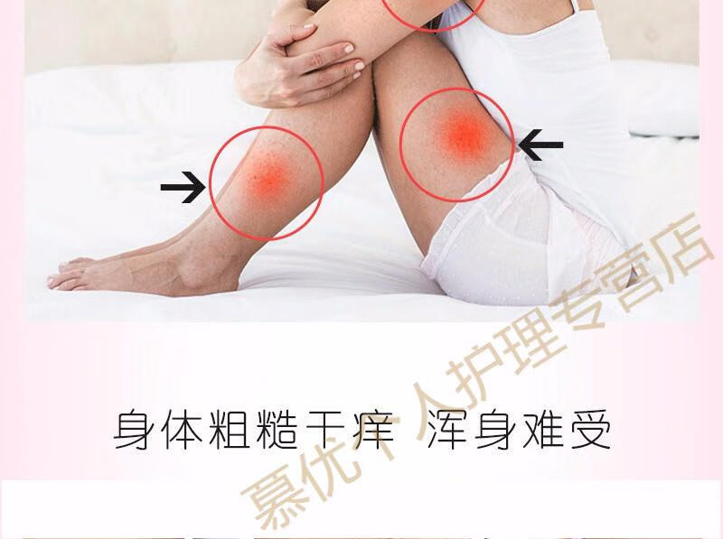 【官方专营】鱼鳞病皮肤霜去鱼鳞背部腿部手臂全身鸡皮肤霜 社皮肤