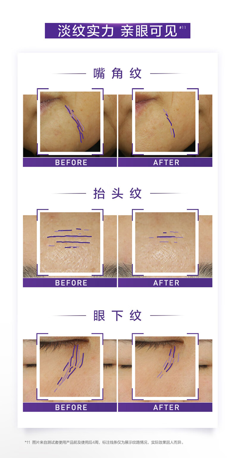 欧莱雅（LOREAL）紫熨斗眼霜二代30ml