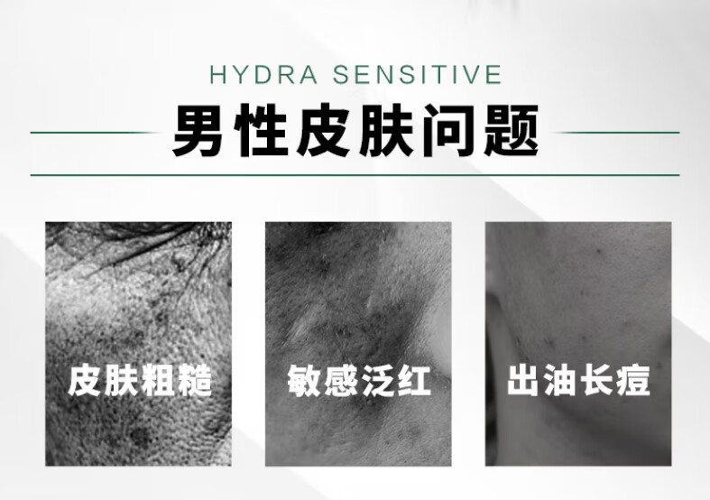 欧莱雅男士舒润强肤水凝露110ml清爽补水舒缓保湿控油清爽温和爽肤水 1瓶装