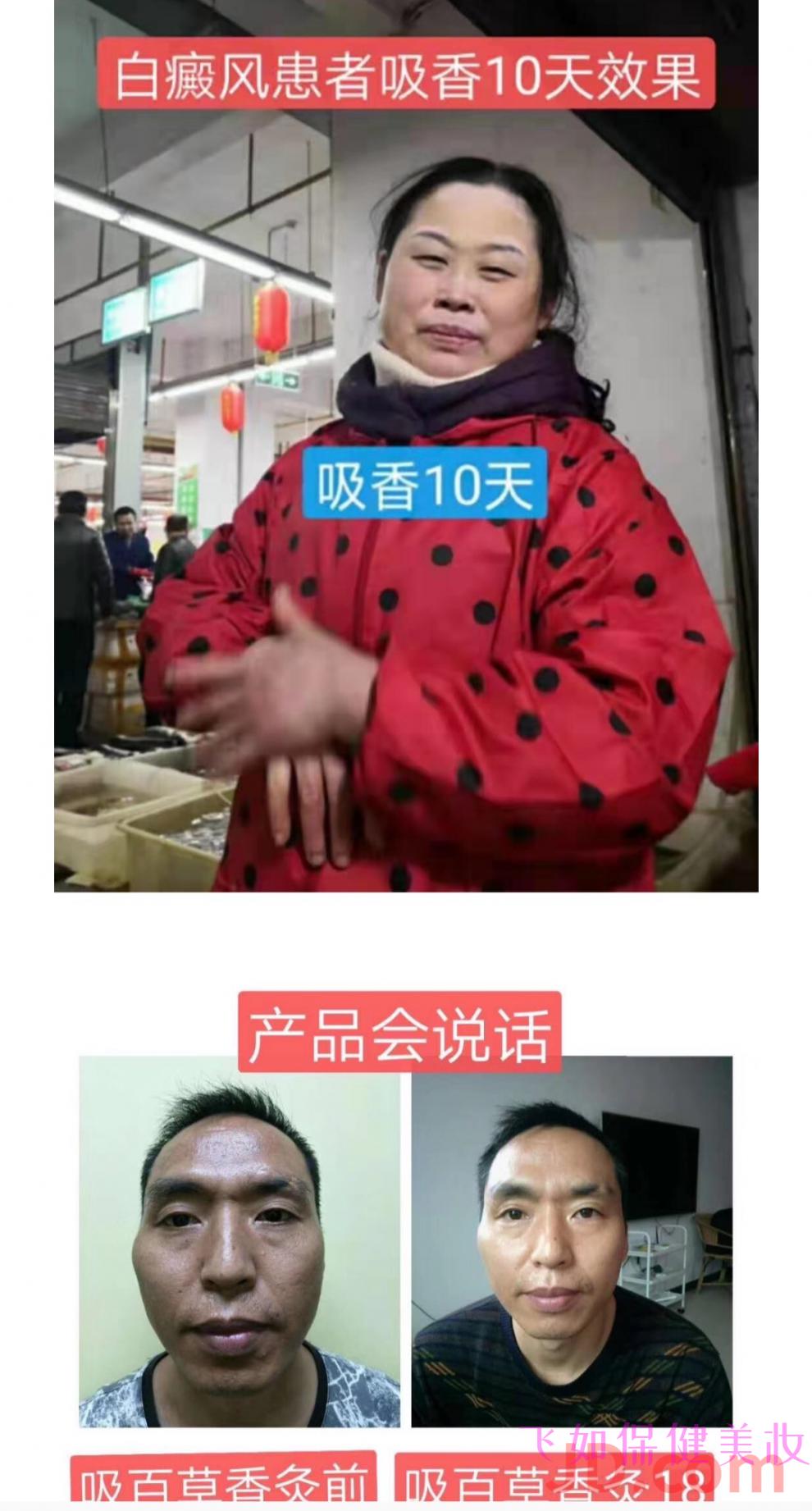 百草香灸百草香灸百草香灸烟馨百草官方正宗香艾香灸微商同款官方正宗