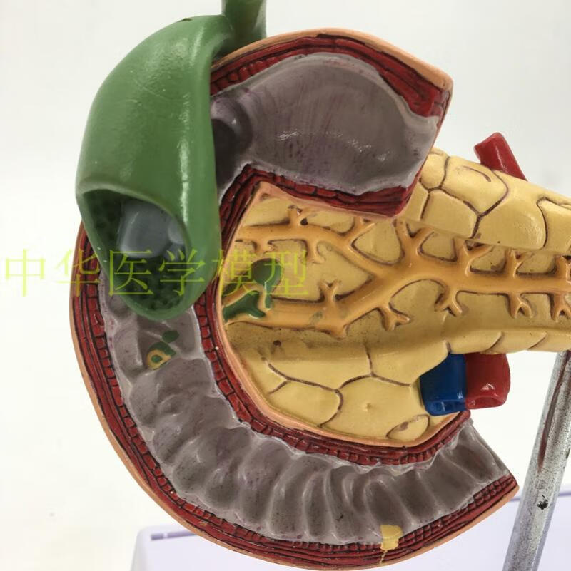 脾胰十二指肠模型胰腺模型脾脏模型肝胆胰腺消化科教学模型正常脾胰