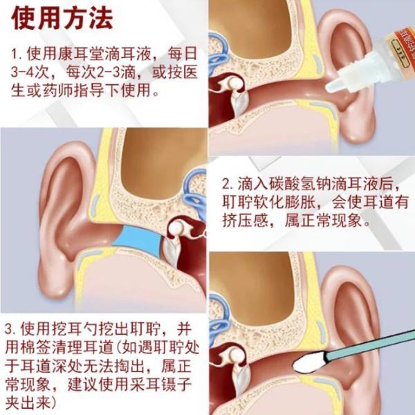 掏耳朵神器发光挖耳勺软化耳屎滴液掏耳朵耵聍水采耳工具儿童宝宝