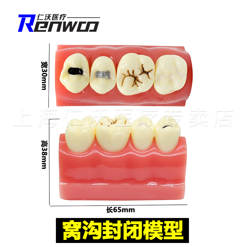 牙齿模型 口腔模型 牙科标准牙模 牙模型 教学假牙带神经医患沟通 25
