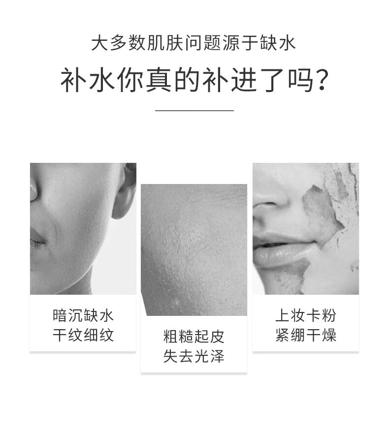 AHC爽肤水男大绿瓶湿敷水女补水闭口粉刺痘痘缩毛孔护肤深度清爽 300ml
