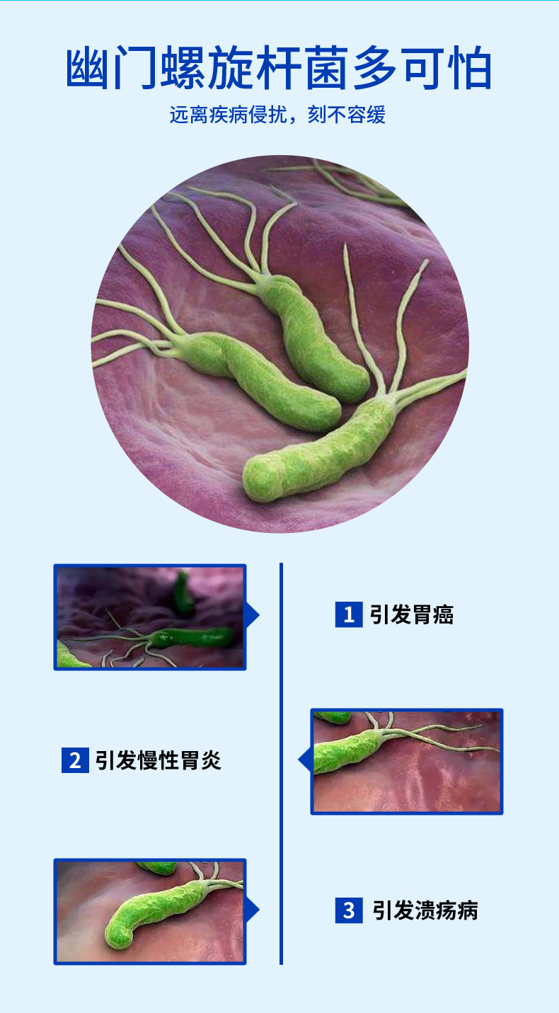 安旭科独立盒装胃幽门螺旋杆菌检纸胃病胃炎粪便抗原试纸口臭幽门螺