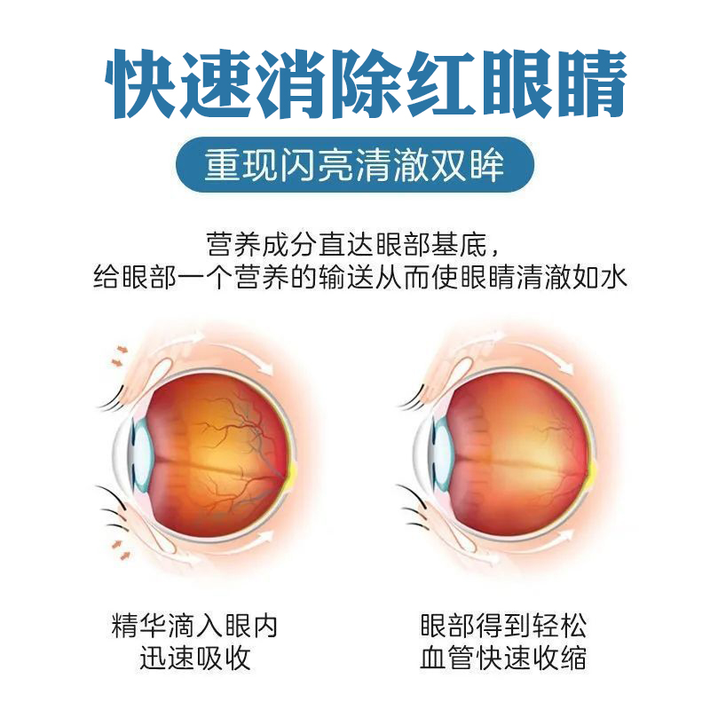 奔泰密蒙花液角膜结膜眼干眼红眼痒jm 1盒【体验装【图片 价格 品牌