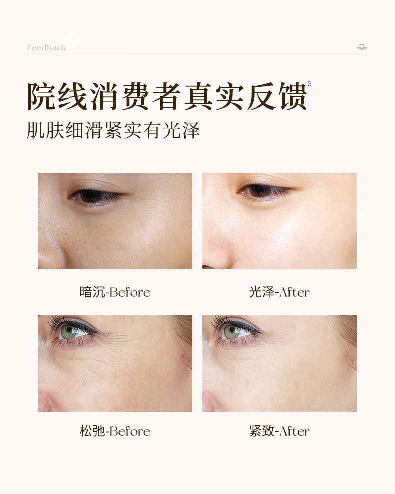 EXPRESSIONS新加坡进口玫瑰面部精油提拉紧致淡细纹保湿抗皱精华液提亮肤色