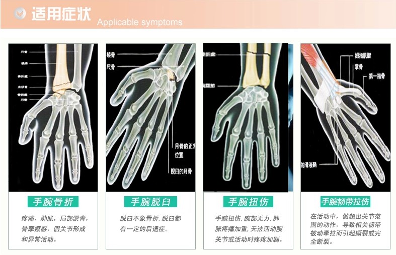 手腕骨折固定护具 腕关节固定带尺桡骨骨裂术后护具手脖支具护腕透气