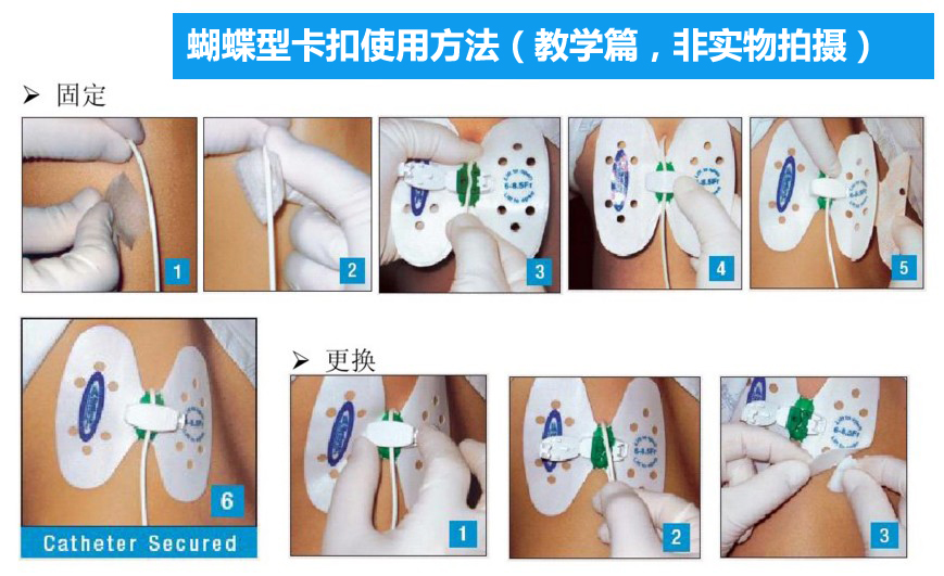 进口巴德引流管固定装置蝴蝶卡扣固定器思乐扣胆管固定贴 白色