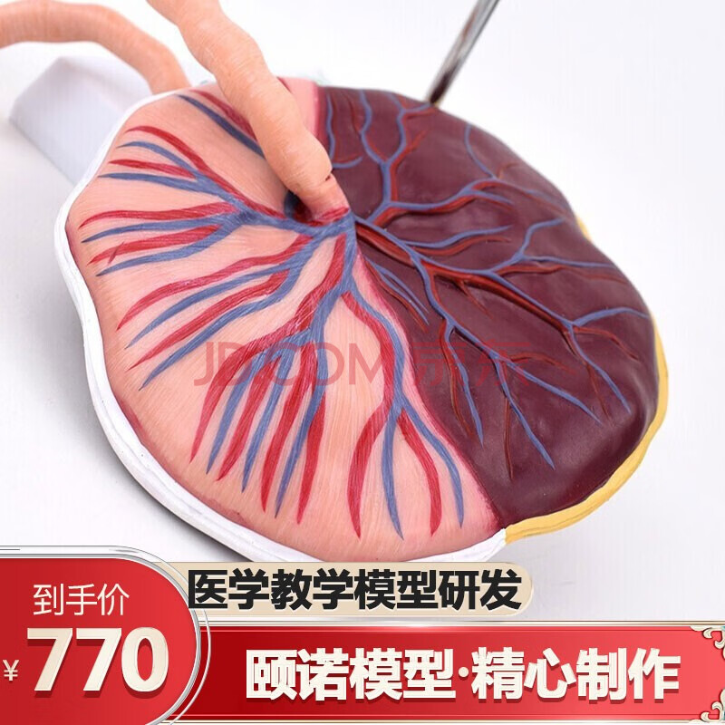 颐诺 胎盘脐带组织结构解剖模型妊娠组织胚胎教学妇产科教学教具胎盘
