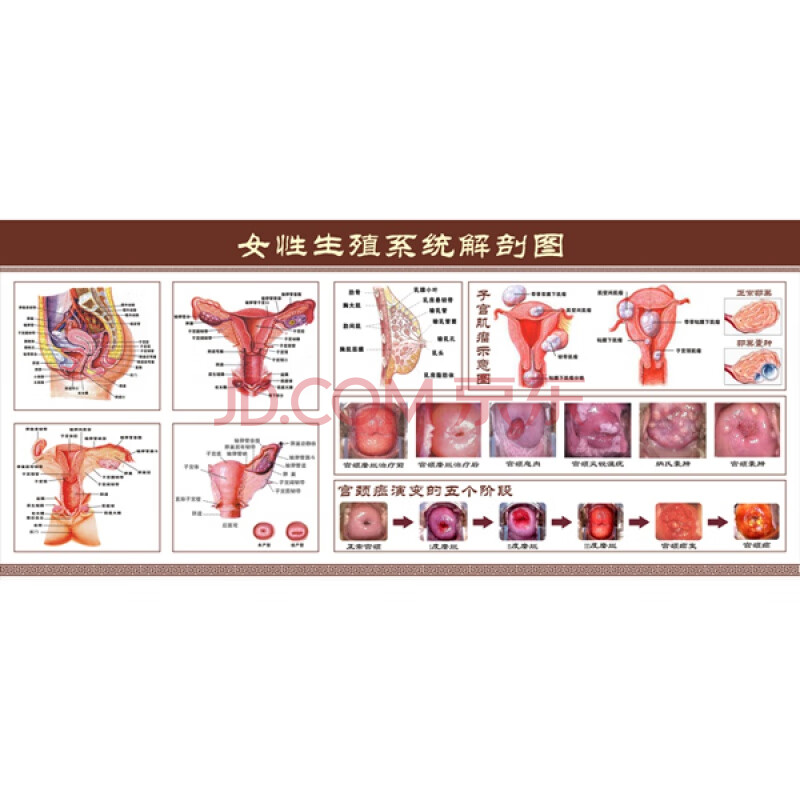 女性生殖器解剖图海报挂图 医院宣传妇科知识海报宫颈疾病示意图 pp胶