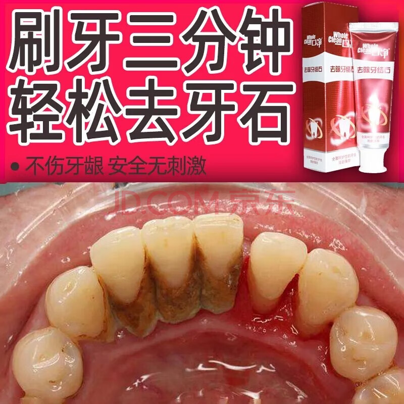 一口净红色牙结石牙膏溶解牙石 速效 洗牙垢牙结石清洗 牙黄牙渍器