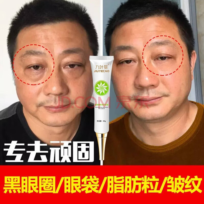 去细纹淡化脂肪粒修复抬头鱼尾纹提拉紧致眼部浮肿精华淡化皱纹化妆 1