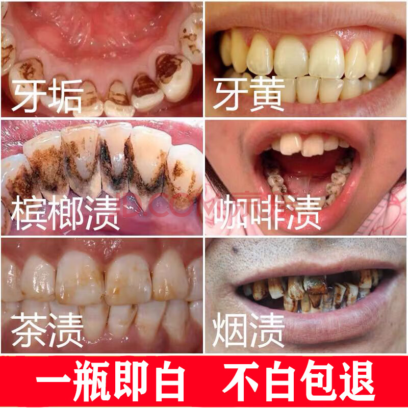 同仁堂洗牙粉牙齿非美白黄牙结石速效洗白牙渍牙垢牙斑净亮白洁牙变白