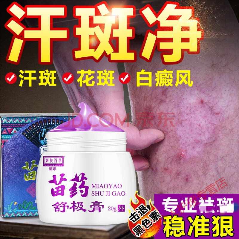 止汗汗i斑专用箹膏去白汗i斑i癣净露祛花i斑班藓白癜风外用皂箹软膏