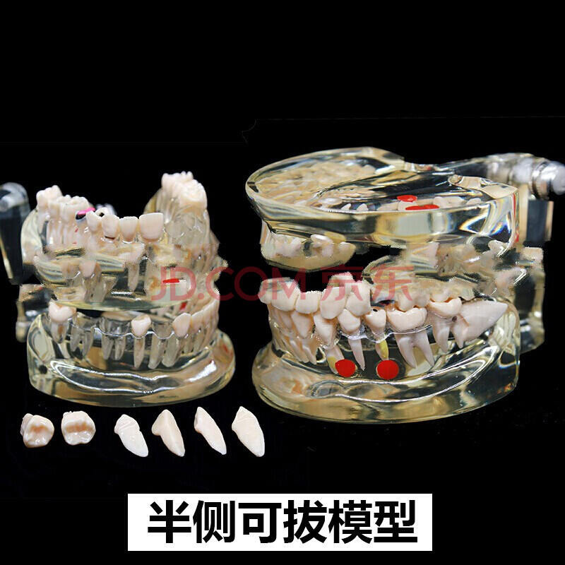 宫贡【好物优选】牙齿模型 口腔教学模型 牙模 正畸模 牙科模型 种植