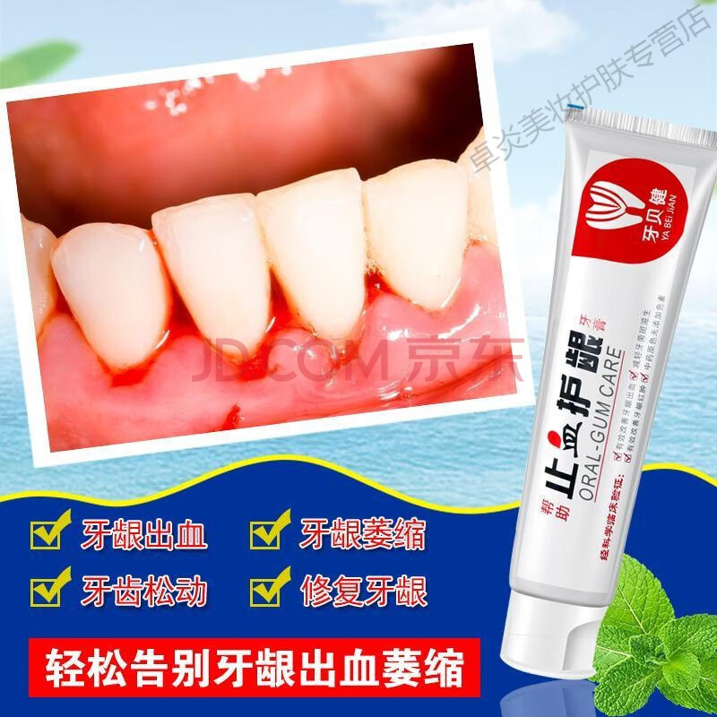 牙膏牙龈萎缩修复牙膏治牙龈出血牙齿松动活力牙炎蛀牙再生成人牙疼痛