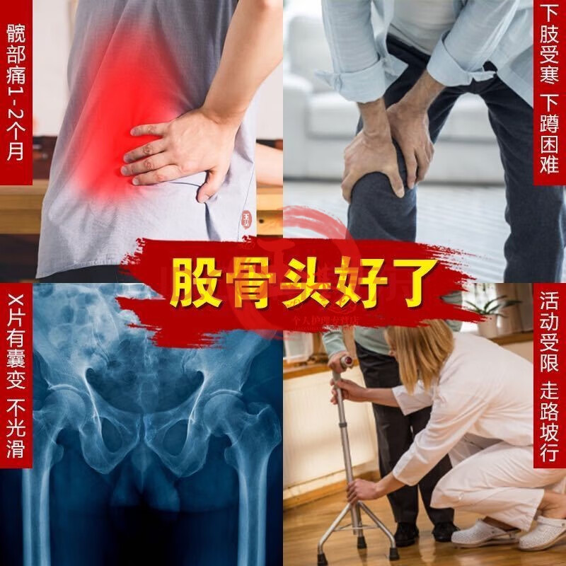 股骨头坏死专用贴特i效缺血性髋关节疼痛塌陷活动受限