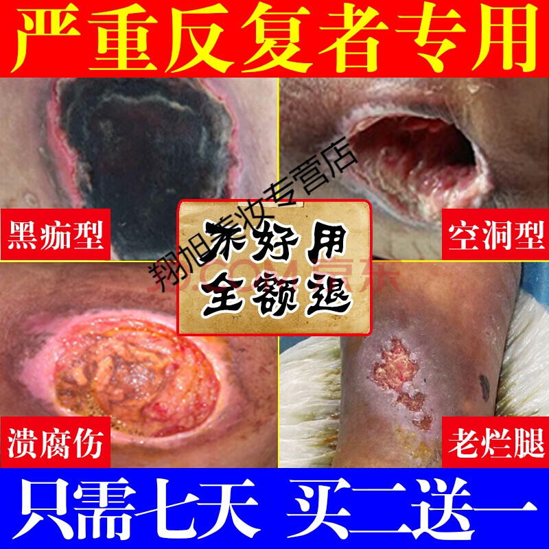 去腐i生肌膏褥i疮伤口合愈老人祛去腐i生肌膏臀部外用膏箹重度贴老烂