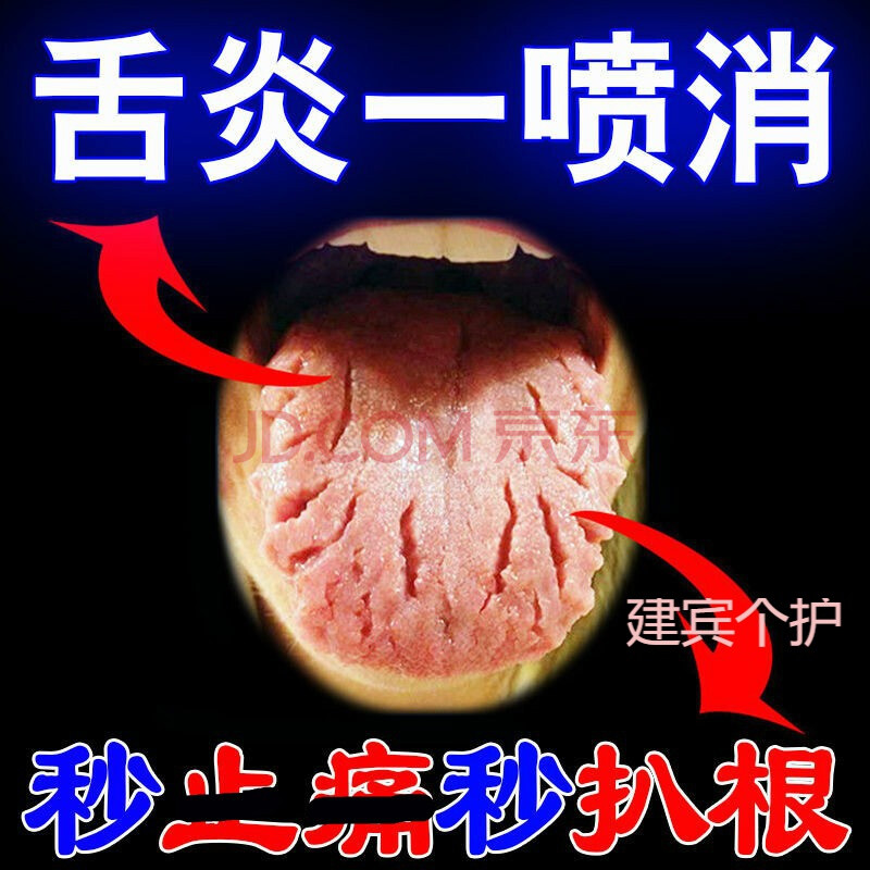 专治56种舌炎喷剂【99%已好】舌头烂了疼痛麻木起泡地图舌裂纹舌【买