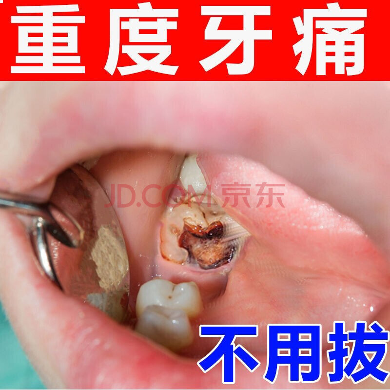 牙痛宁口喷剂牙龈肿痛蛀虫蛀牙疼效快速立可停口腔溃疡上火牙神经痛