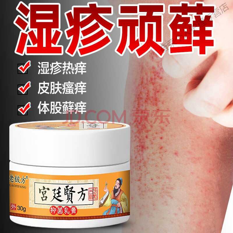 头皮i藓手足i藓花i斑藓体i藓银i屑病治了疗牛皮鲜癣瘙痒止痒湿疹专用