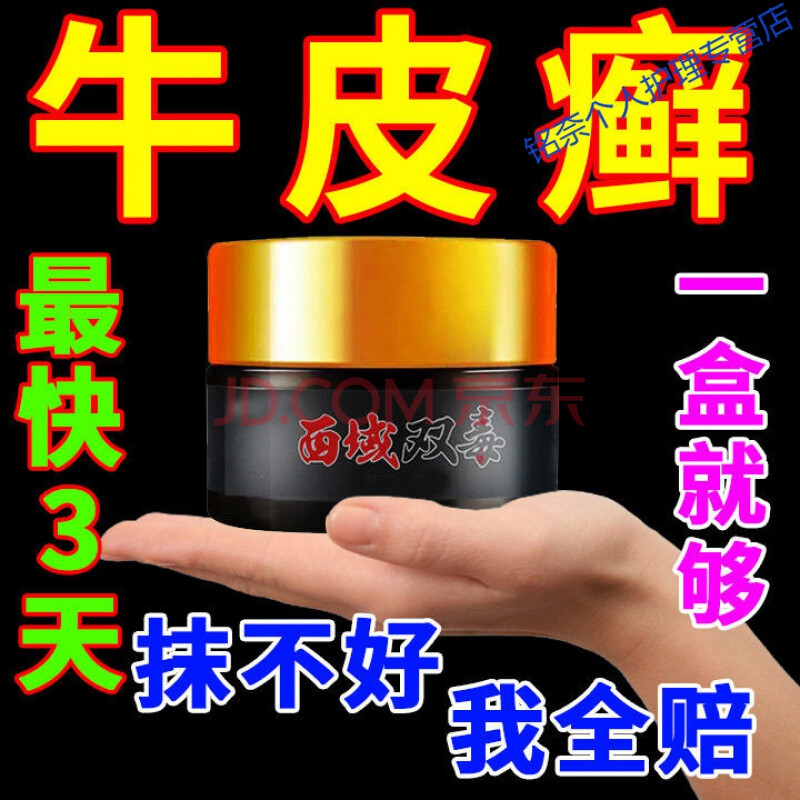 牛皮l癣银l屑病【最快三天消】特效膏皮肤l癣痒灵瘙痒手l癣足l癣头皮