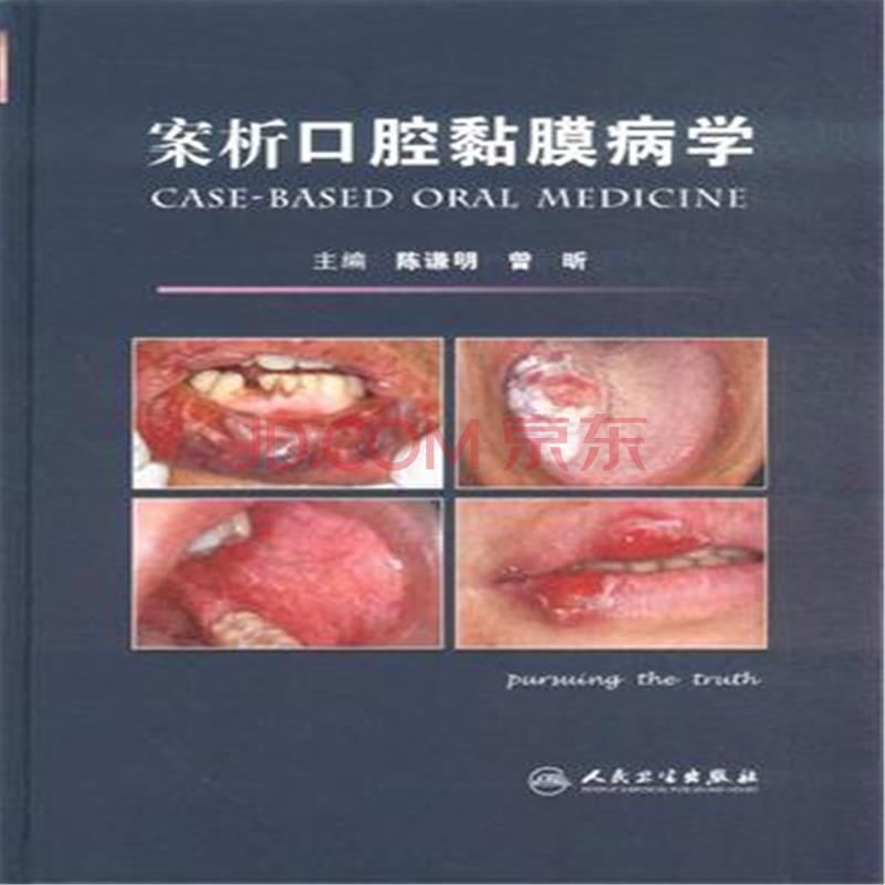 案析口腔黏膜病学