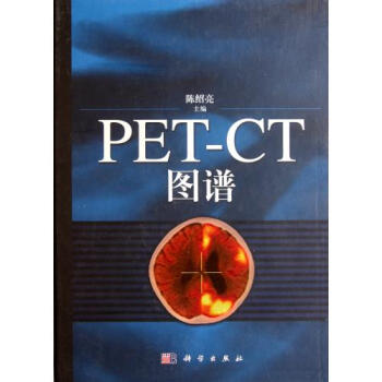 PET-CT图谱(精)【图片 价格 品牌 报价】-京东