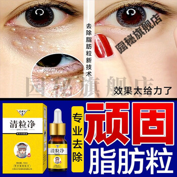 下脂肪颗粒眼周长白点男女眼部精华素眼霜淡化眼部细纹清粒净一瓶10ml